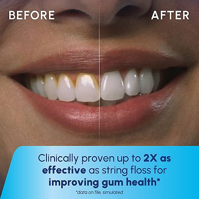 Waterpik Cordless Enhance 3000 Rechargeable Water Flosser