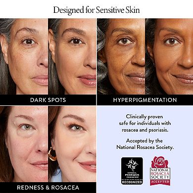 Laura Geller Balance and Brighten Color Correcting Baked Powder Foundation