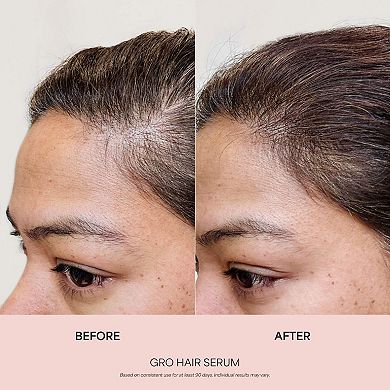GRO Hair Serum and Mini Shampoo and Conditioner Gift Set