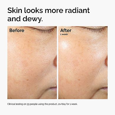 Rice Lipids + Ectoin Microemulsion Moisturizer for Soothing Hydration & Reduced Redness