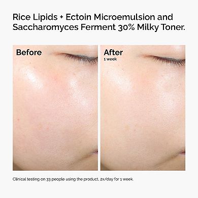 Rice Lipids + Ectoin Microemulsion Moisturizer for Soothing Hydration & Reduced Redness