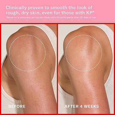 Pink Algae Pro-Retinol Body Butter for Anti-Aging and KP