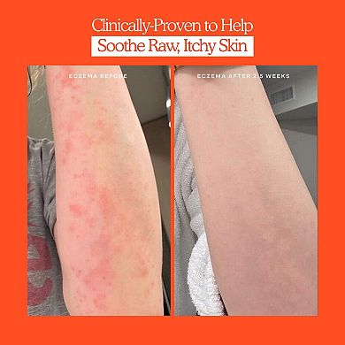 SOS Rescue + Relief Body Wash Treatment