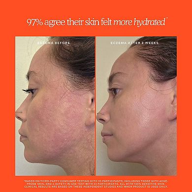 SOS Rescue + Relief Body Wash Treatment