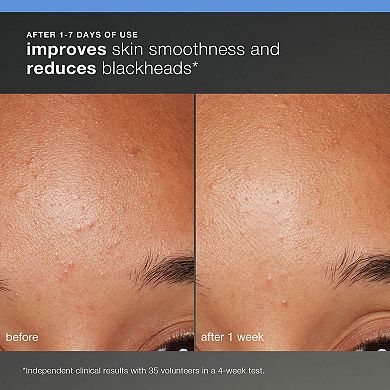 Discover Healthy Skin Kit