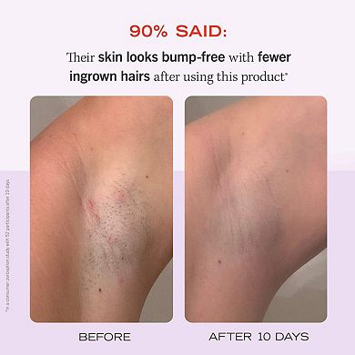 'Ingrown Hair Pads with AHA + BHA for Body + Face'