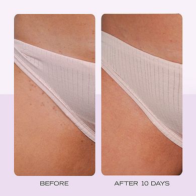 'Ingrown Hair Pads with AHA + BHA for Body + Face'