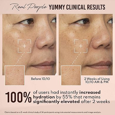 Yummy Skin 10/10 Barrier Boost Hyaluronic Acid + Ectoin Plumping Serum