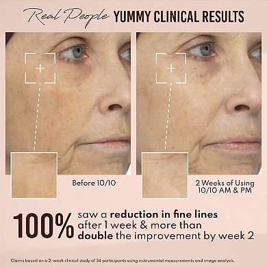 Yummy Skin 10/10 Barrier Boost Hyaluronic Acid + Ectoin Plumping Serum