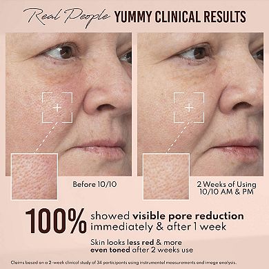 Yummy Skin 10/10 Barrier Boost Hyaluronic Acid + Ectoin Plumping Serum
