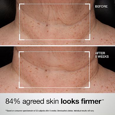 StriVectin TL Advanced™ Tightening Neck & Chest Lotion SPF 35