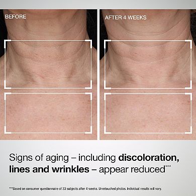 StriVectin TL Advanced™ Tightening Neck & Chest Lotion SPF 35