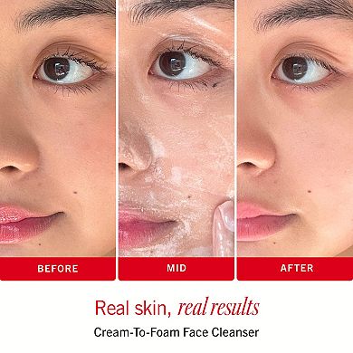 Sensitive Skin Bestsellers Skincare Routine Travel Set