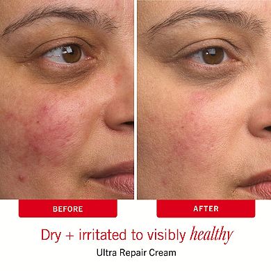 Sensitive Skin Bestsellers Skincare Routine Travel Set