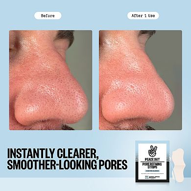 Peace Out Pore Refining Strips for Blackheads & Clogged Pores