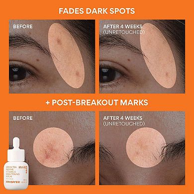 Mini Vitamin C Rapid Brightening Gift Set for Dark Spots