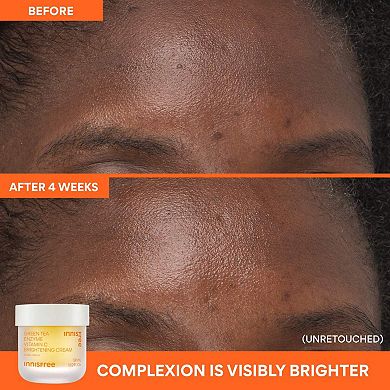 Mini Vitamin C Rapid Brightening Gift Set for Dark Spots