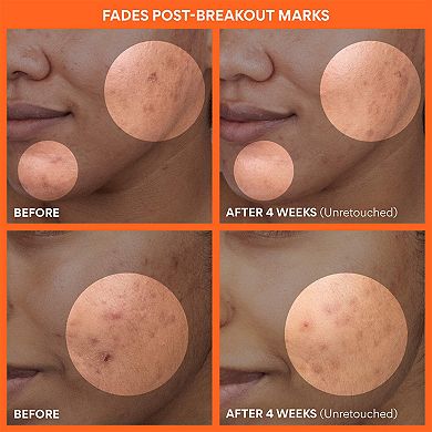 Mini Vitamin C Rapid Brightening Gift Set for Dark Spots