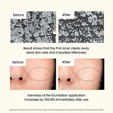 Skin Refining Mild PHA Toner with 8% PHA for Gentle Exfoliation