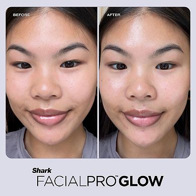Shark® FacialPro Glow At Home Hydro-Powered System