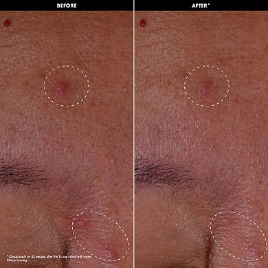 CLEAR & PURIFY - Active Powder with Mandelic Acid + Ectoin