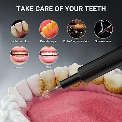 YEVYO Plaque Remover for Teeth, Ultrasonic Tooth Cleaner, Hard Tartar Remover Tool