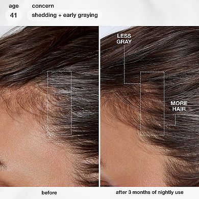 FutureIQ Hair Longevity Serum for Graying, Thinning, & Scalp Aging