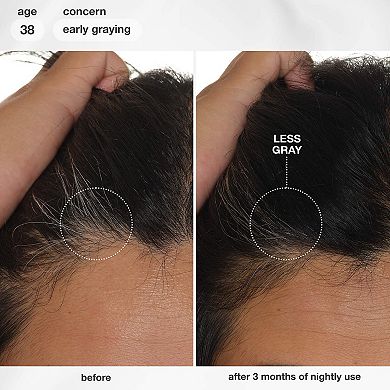 FutureIQ Hair Longevity Serum for Graying, Thinning, & Scalp Aging
