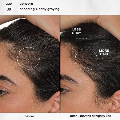 FutureIQ Hair Longevity Serum for Graying, Thinning, & Scalp Aging