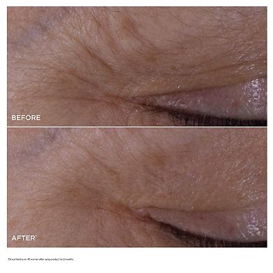 DOUBLE SERUM Eye Brightening & Depuffing Anti-Aging Concentrate