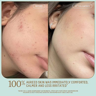 Probiotic Gel Lightweight Non-Comedogenic Moisturizer with Glycerin + Squalane