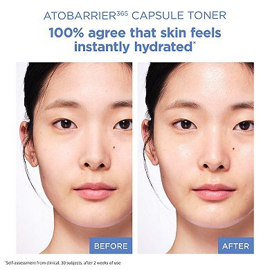 ATOBARRIER365 Hydrating and Lightweight Capsule Toner for Sensitive Skin