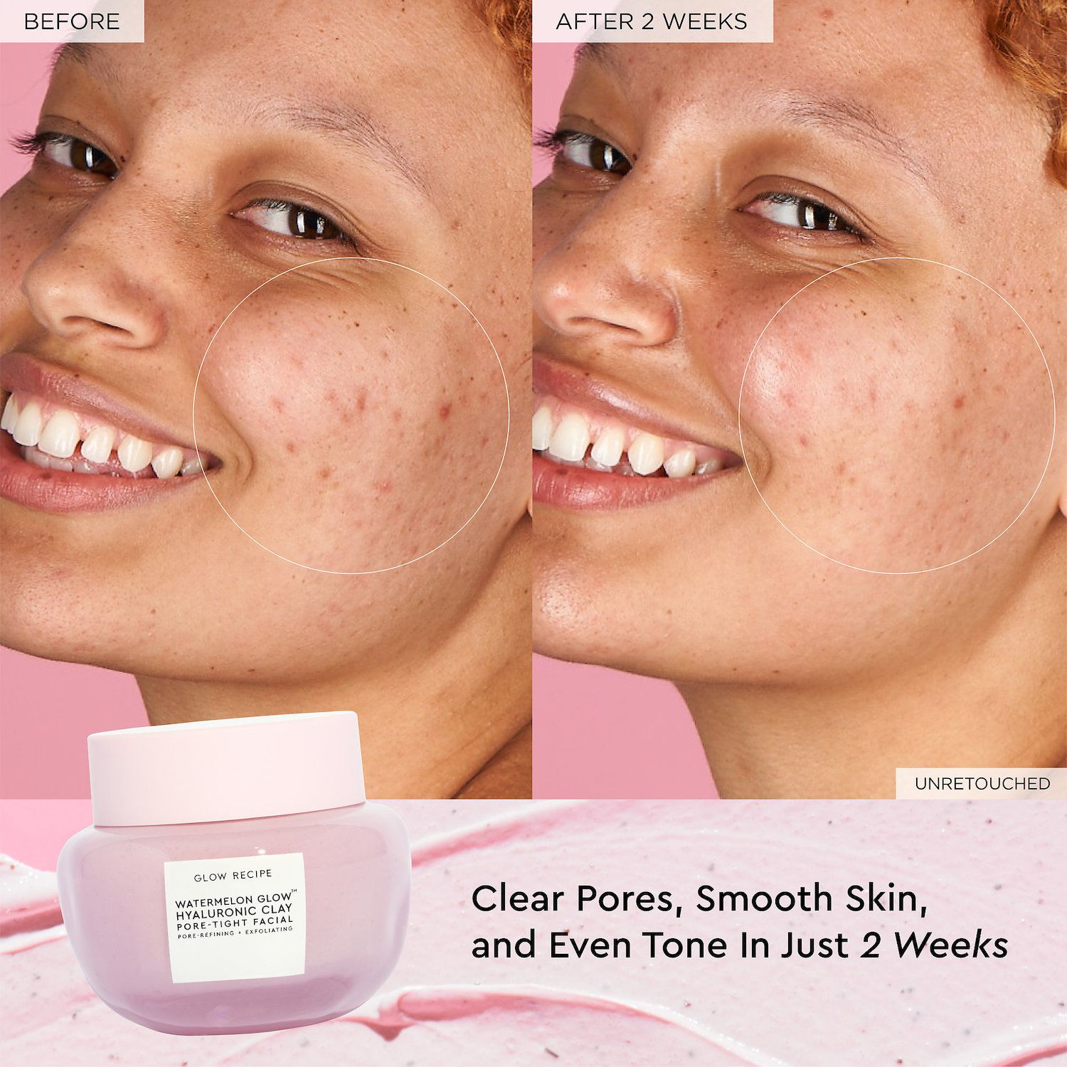 GLOW RECIPE☆ヒアルロン酸配合☆Watermelon Tight Facial Mask Glow Recipe Watermelon Glow Hyaluronic Clay Pore-Tight