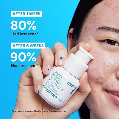 innisfree Gentle Retinol + Salicylic Acid Acne Serum for Blemishes