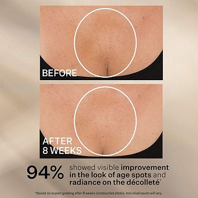 StriVectin TL Advanced Tightening Neck Cream PLUS with Alpha-3 Peptide