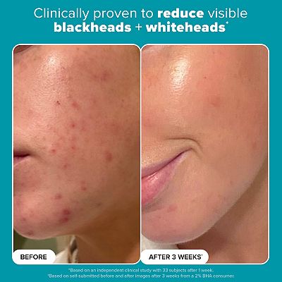 Paula's Choice BHA Expert Exfoliation Duo