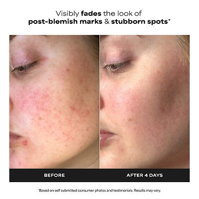 Paula's Choice 10% Azelaic Acid Booster for Redness Relief
