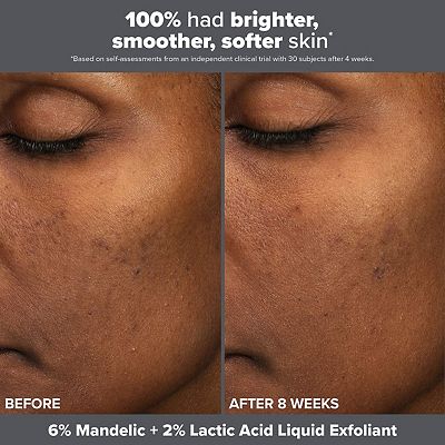 Paula's Choice The Exfoliation Experience Kit with 2% BHA + 6% Mandelic Acid AHA