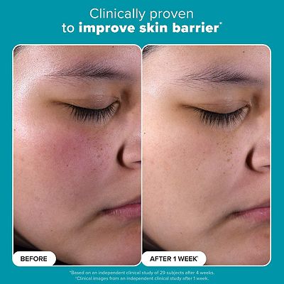 Paula's Choice Skin Perfecting 2% BHA Liquid Exfoliant