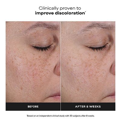 paula's choice vitamin c glutathione Amazon.com: Paula's Choice 25% Vitamin C Serum with Glutathione &  Antioxidants, Face Serum Improves Discoloration, Uneven Tone & Firms, All  Skin Types, Fragrance-Free, 1oz : Beauty & Personal Care main image 1