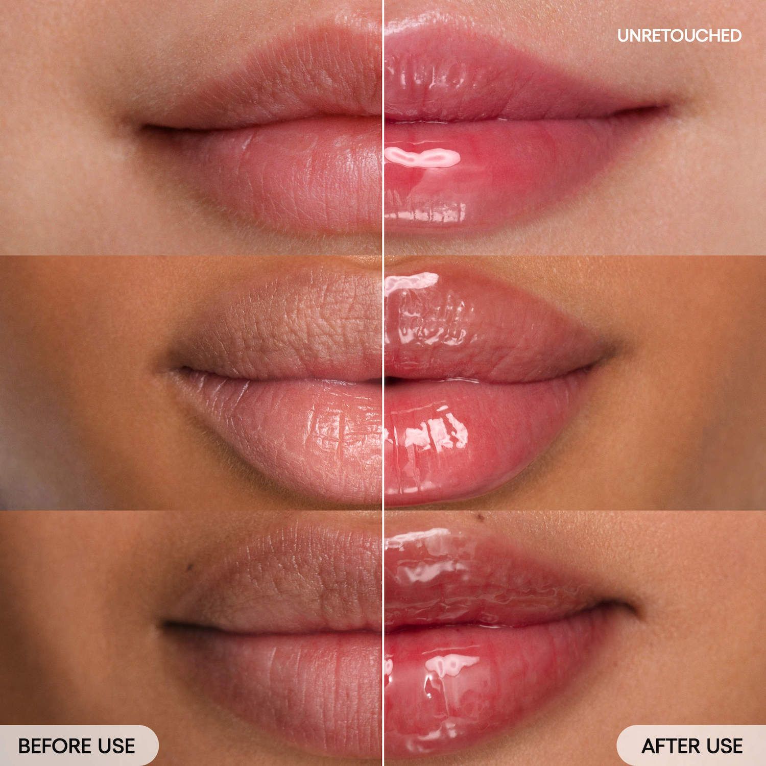 vitamin c dry lips CERAMIDE & VITAMIN C LIP BALM 10G  Quadis